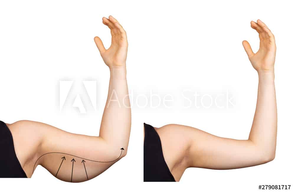 Read more about the article The Different Types of Plastic Surgery