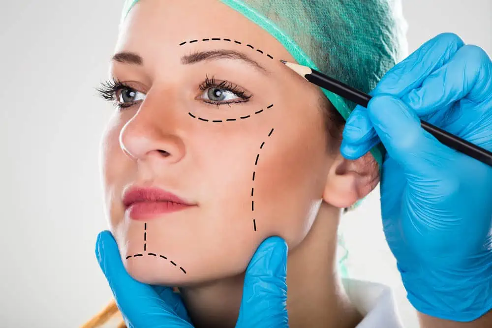 A woman wearing a surgical cap is marked with dashed lines on her face by a gloved plastic surgeon, indicating areas for cosmetic surgery or a procedure.